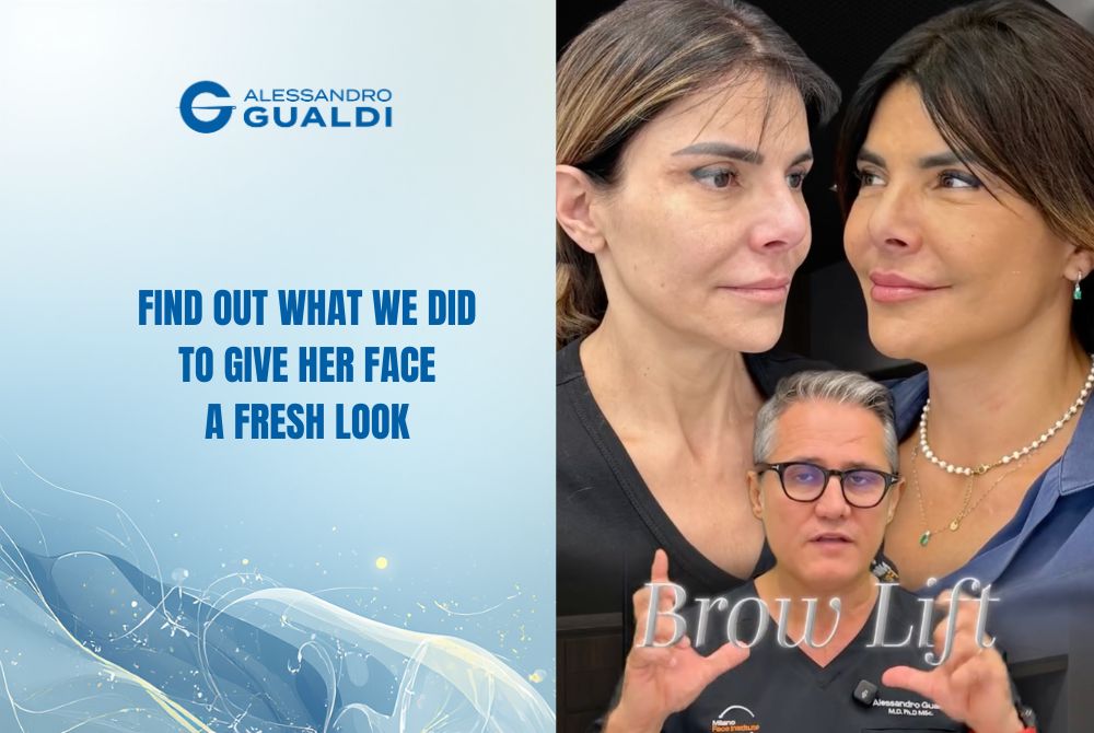 Preservation Facelift and Brow Lift