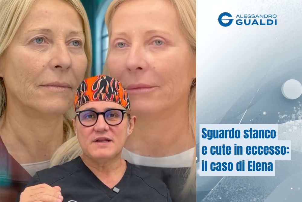 blefaroplastica superiore risultati dopo due settimane