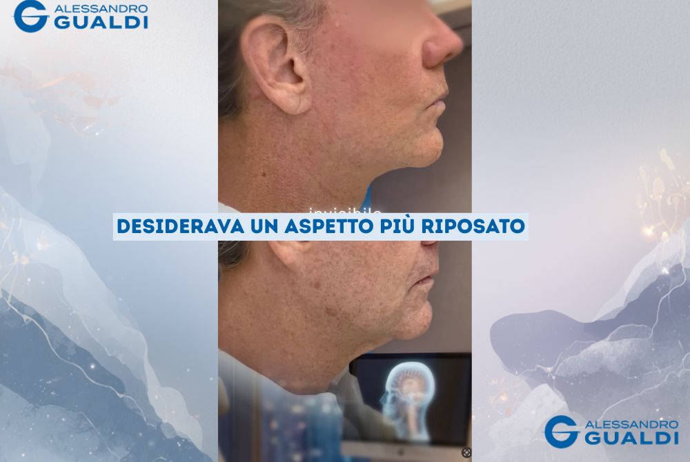 lifting collo e mandibola uomo