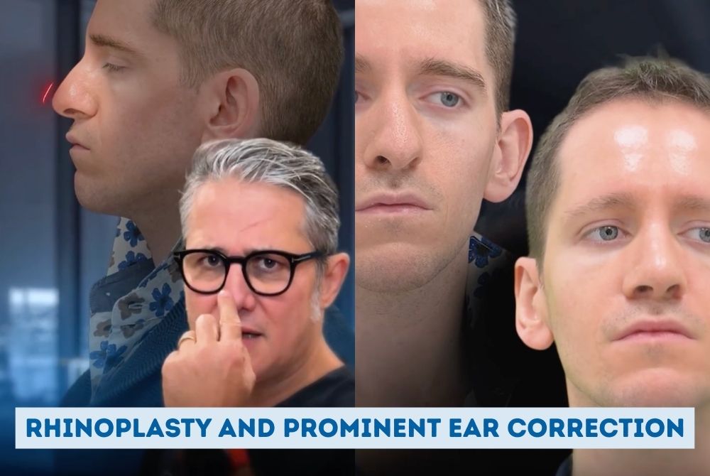 Male rhinoplasty and otoplasty