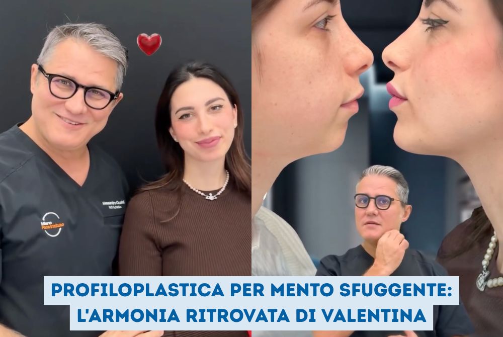 Profiloplastica mento sfuggente