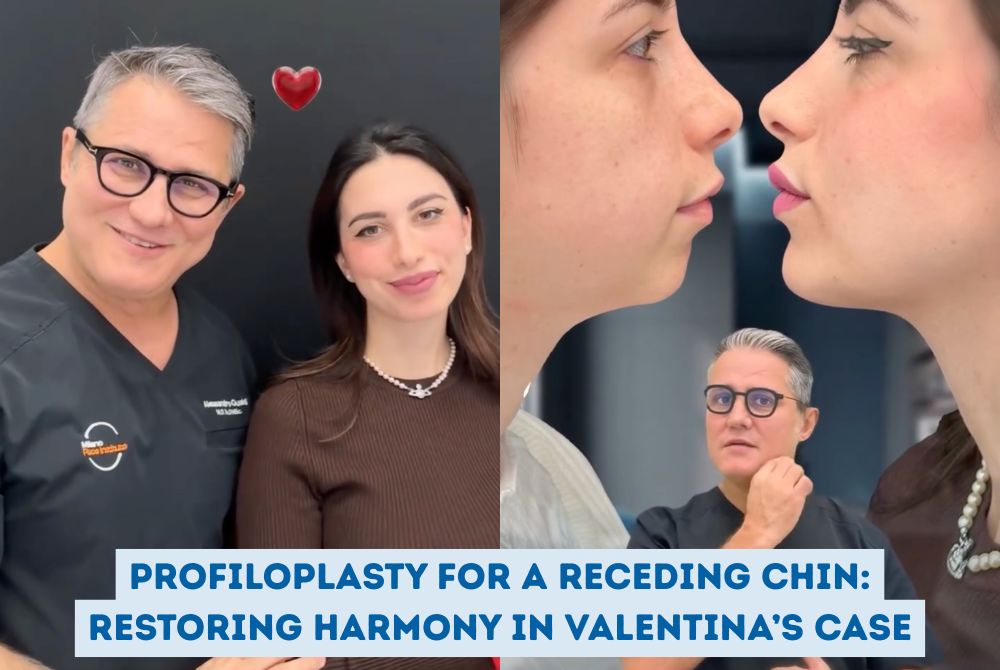 Profiloplasty receding chin