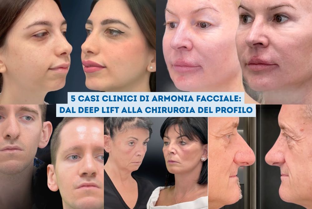 casi clinici chirurgia facciale