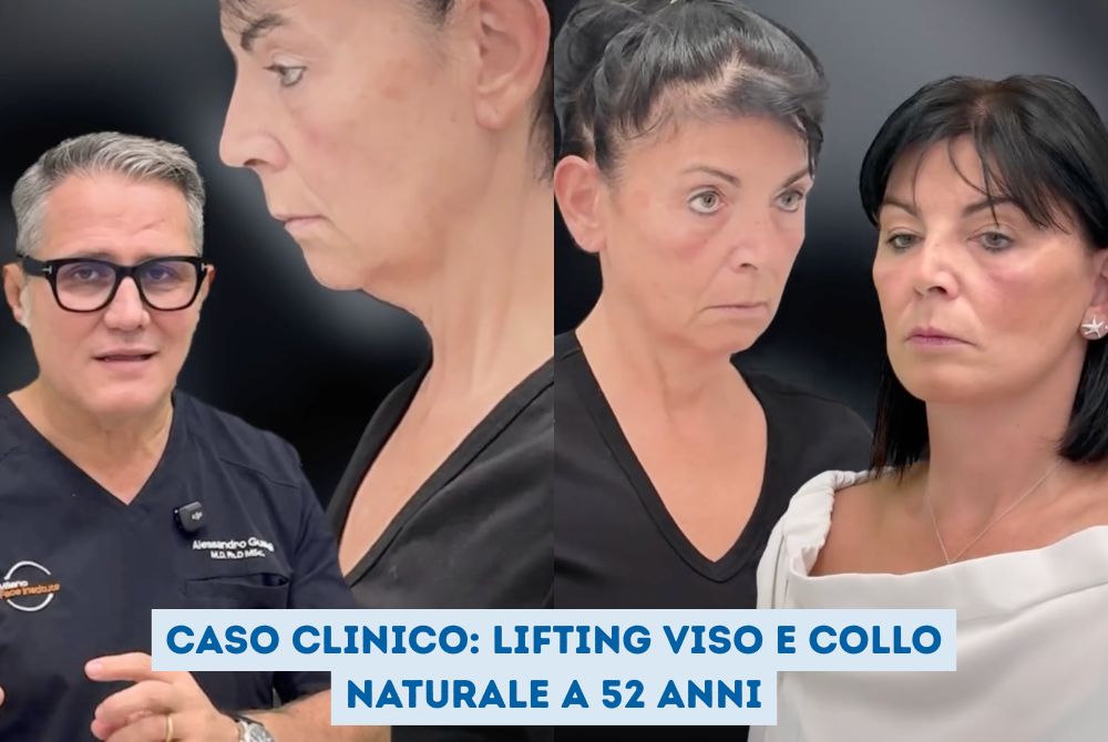 Caso clinico lifting viso e collo